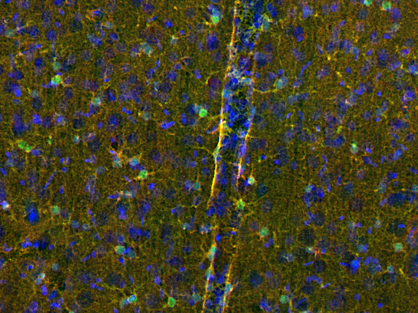 Glycogen phosphorylase Polyclonal rabbit purified antibody - image 3