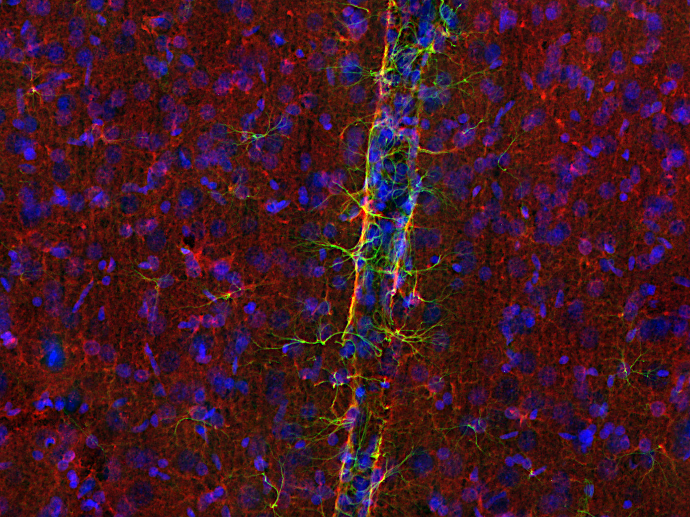 Glycogen phosphorylase Polyclonal rabbit purified antibody - image 4