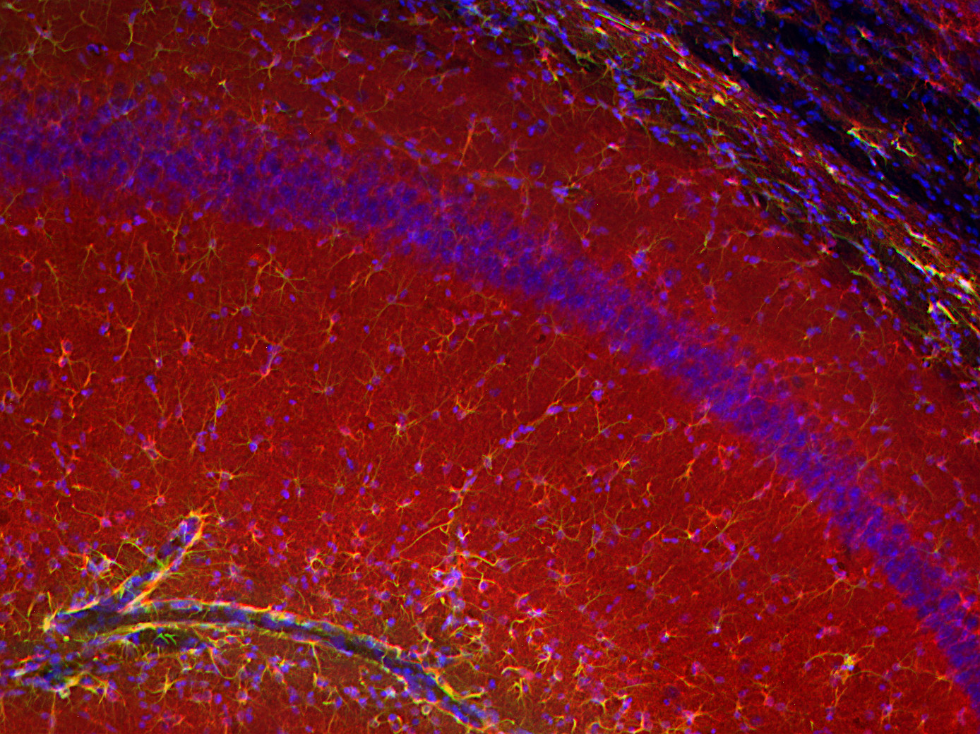 Glycogen phosphorylase Polyclonal rabbit purified antibody - image 5
