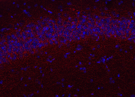 Cannabinoid receptor CB1-R Polyclonal Guinea pig antiserum - image 2