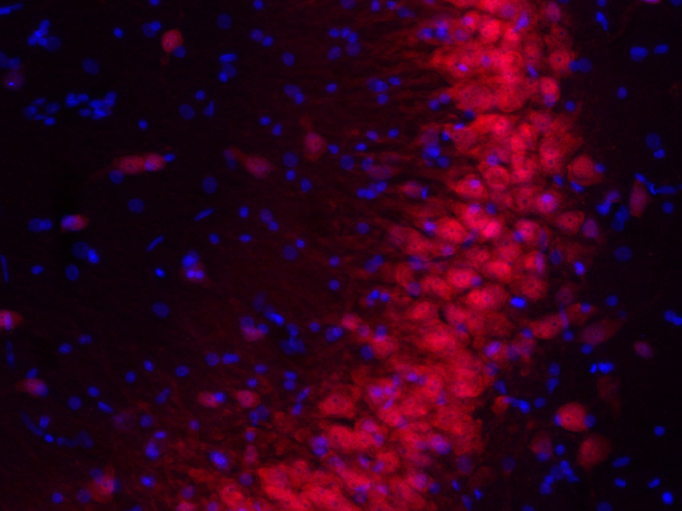 NeuN, Polyclonal Guinea pig antiserum