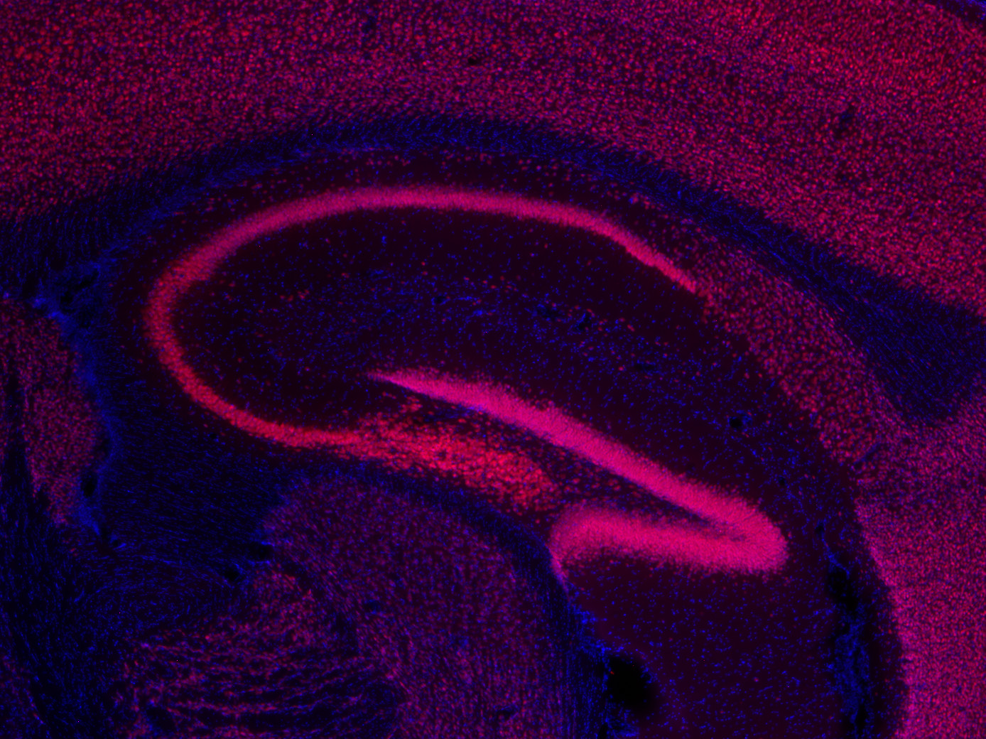 NeuN, Polyclonal Guinea pig antiserum