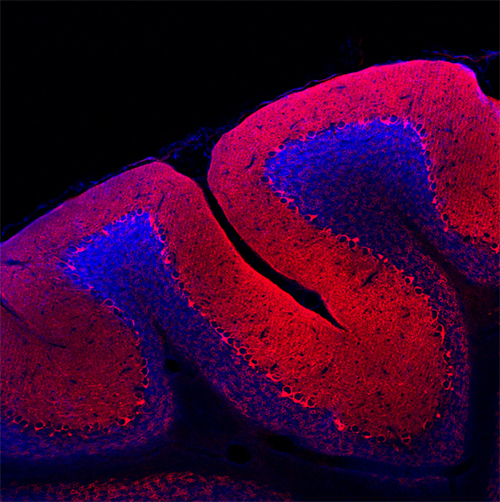 GABA transporter1 Polyclonal rabbit antiserum - image 3