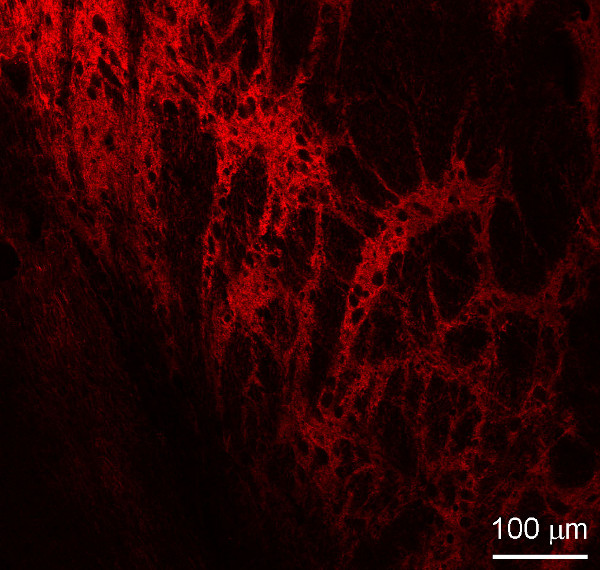 GABA transporter3 Polyclonal Guinea pig antiserum - image 3