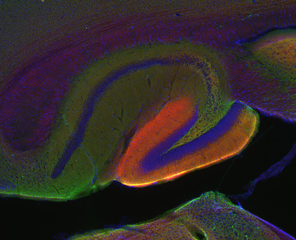 EPB41L1 / 4.1N Polyclonal rabbit purified antibody - image 3
