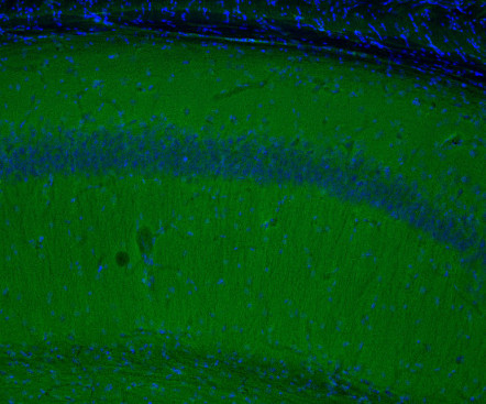 beta-Catenin Polyclonal Guinea pig antiserum - image 3