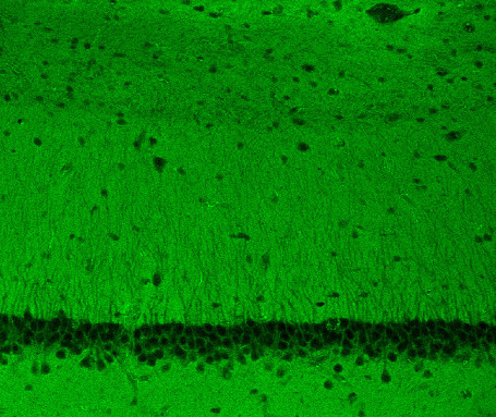 beta-Catenin Polyclonal Guinea pig antiserum - image 4