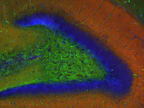 PRG1, Polyclonal rabbit antiserum