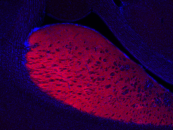 DAT, Polyclonal rabbit purified antibody