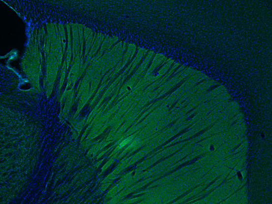 DAT Polyclonal chicken purified antibody - image 1