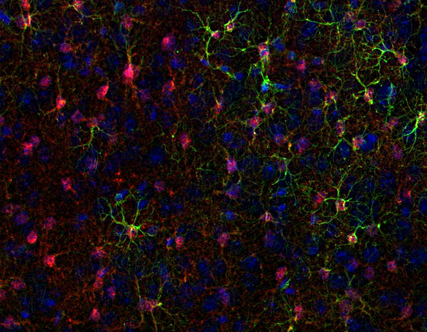S100B Polyclonal Guinea pig antiserum - image 2