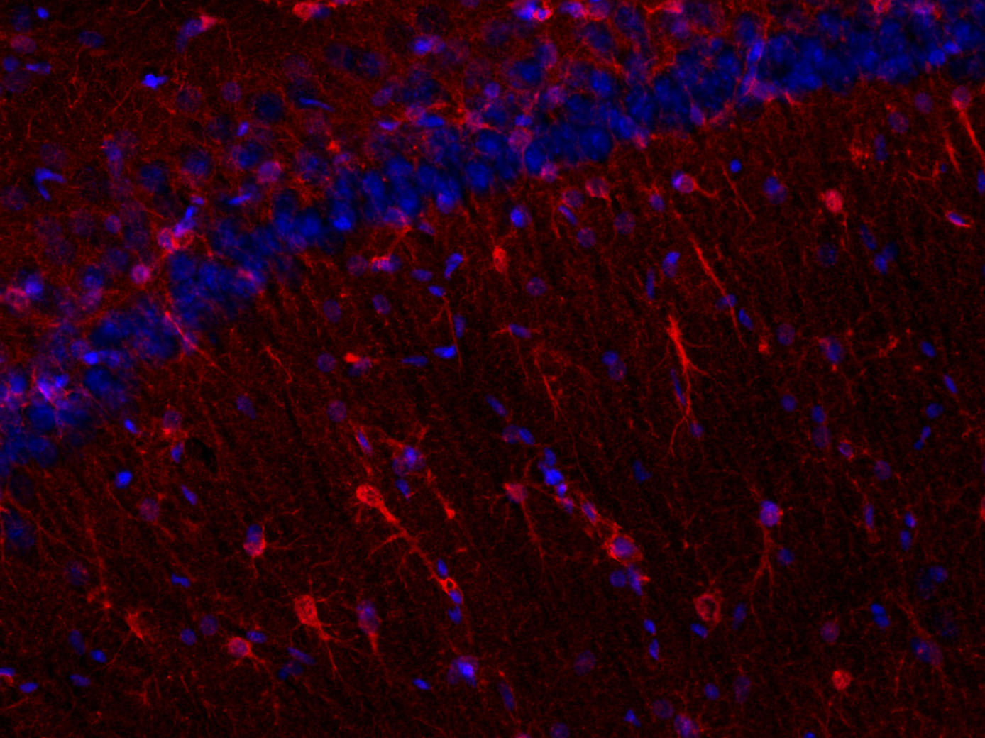 S100B Recombinant rabbit - image 3