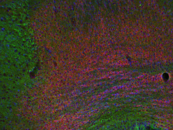 EPS8, Polyclonal rabbit purified antibody