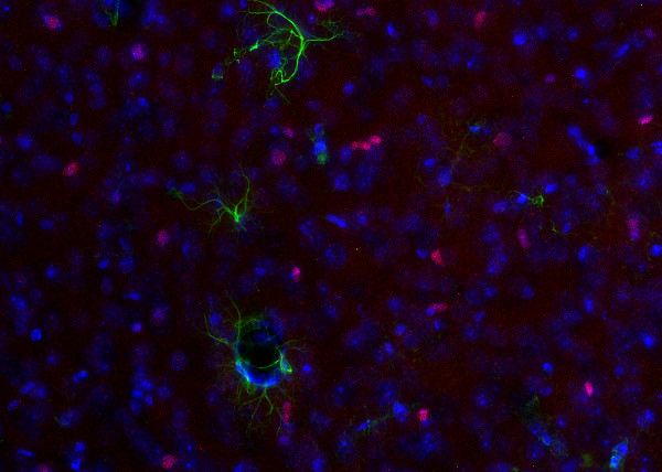 Olig2, Polyclonal rabbit purified antibody