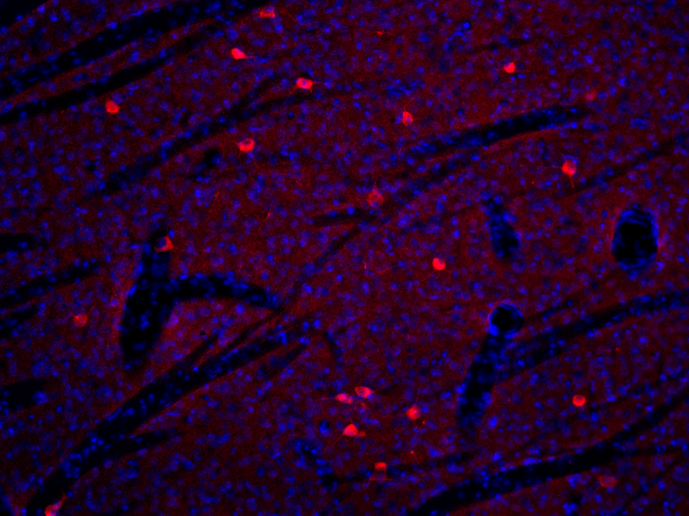 ChAT Recombinant rabbit - image 1