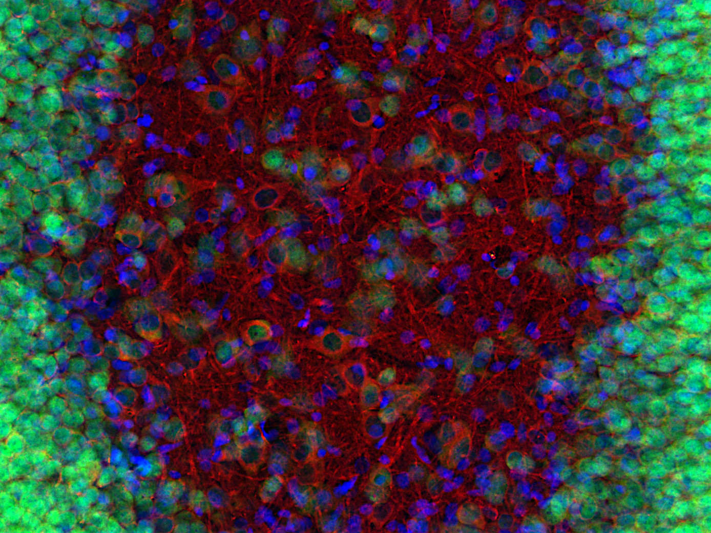 beta3-Tubulin Recombinant rabbit - image 3