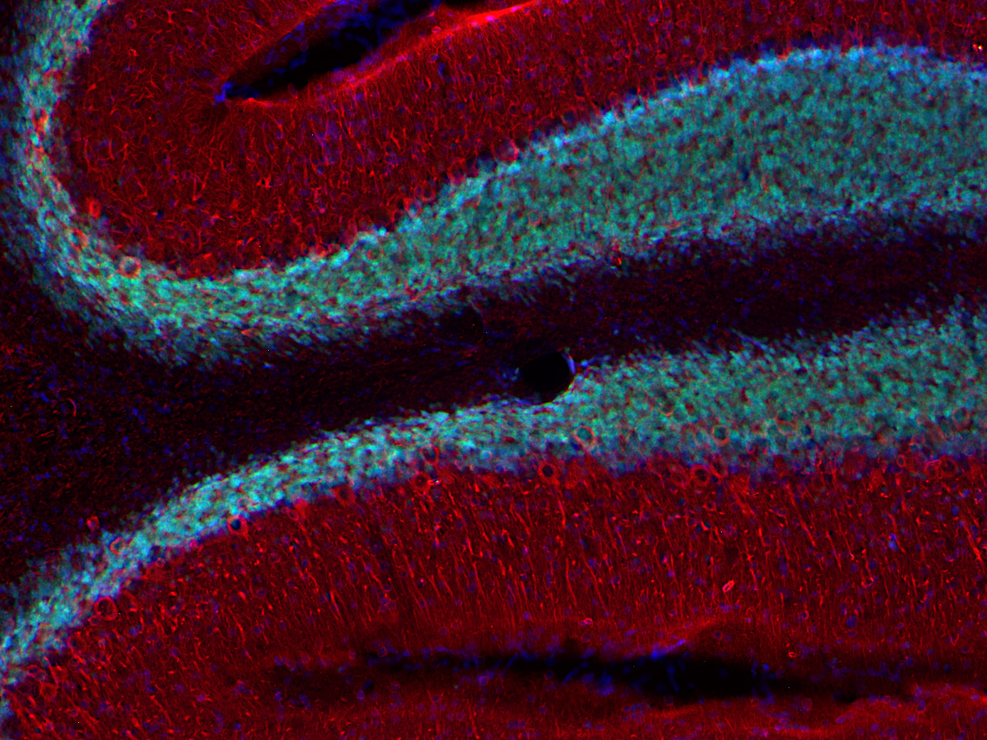 beta3-Tubulin Recombinant rabbit - image 4