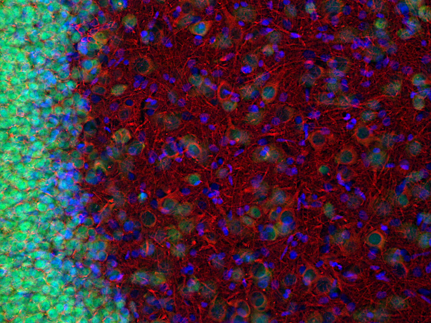 beta3-Tubulin Recombinant rabbit - image 5