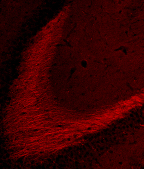 Tau, Polyclonal rabbit antiserum