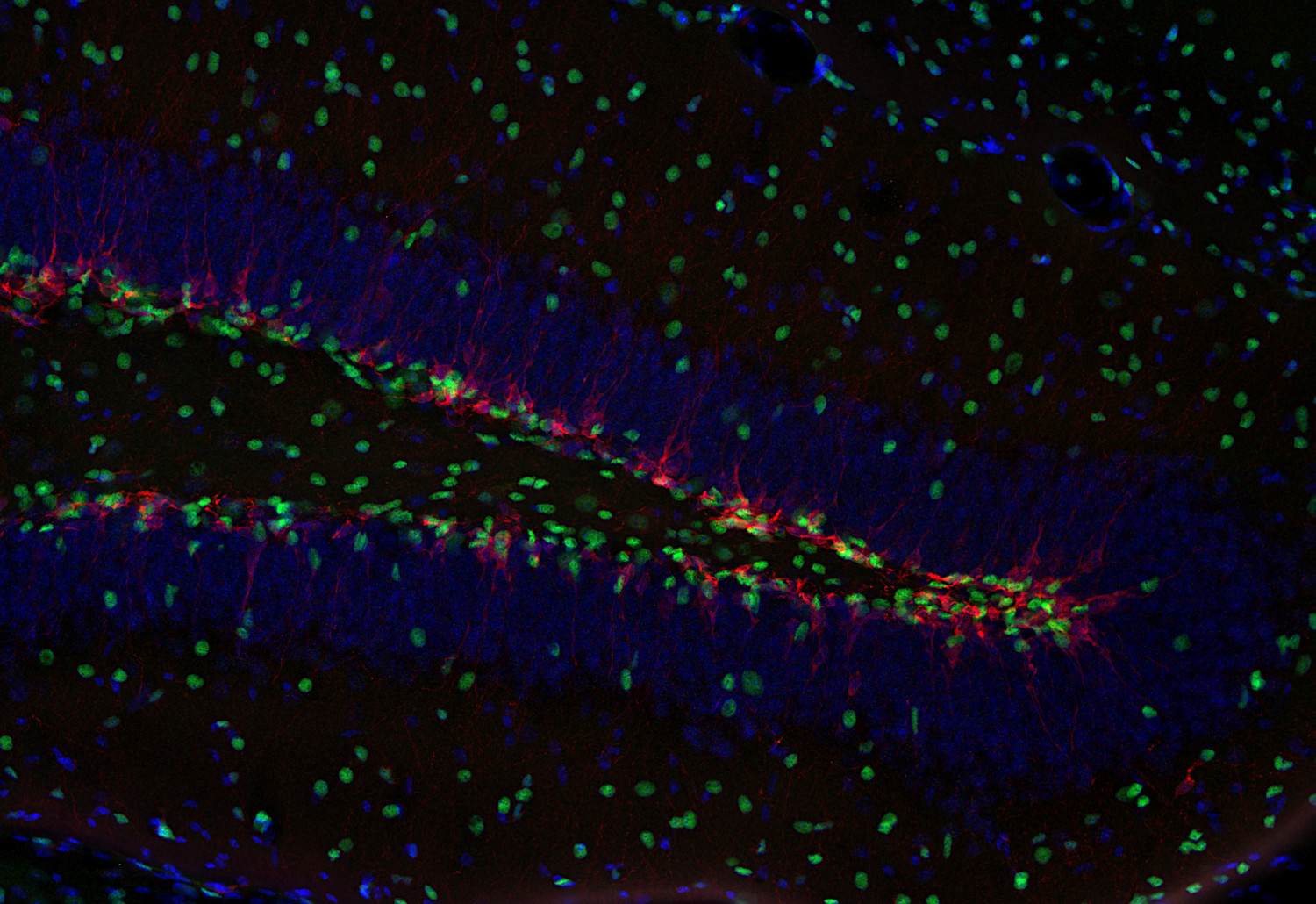 Doublecortin, Polyclonal Guinea pig antiserum