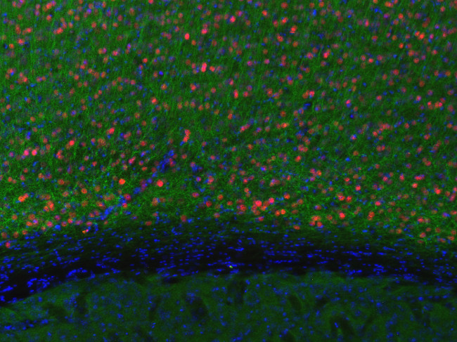 SATB2, Polyclonal Guinea pig antiserum
