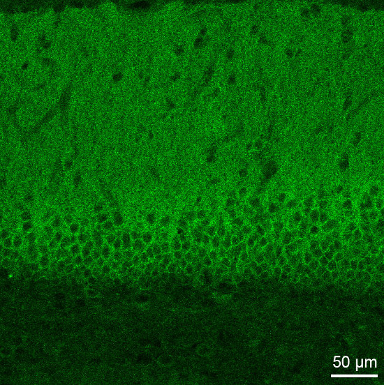 Ca2+ channel L-type alpha-1C Polyclonal rabbit purified antibody - image 2