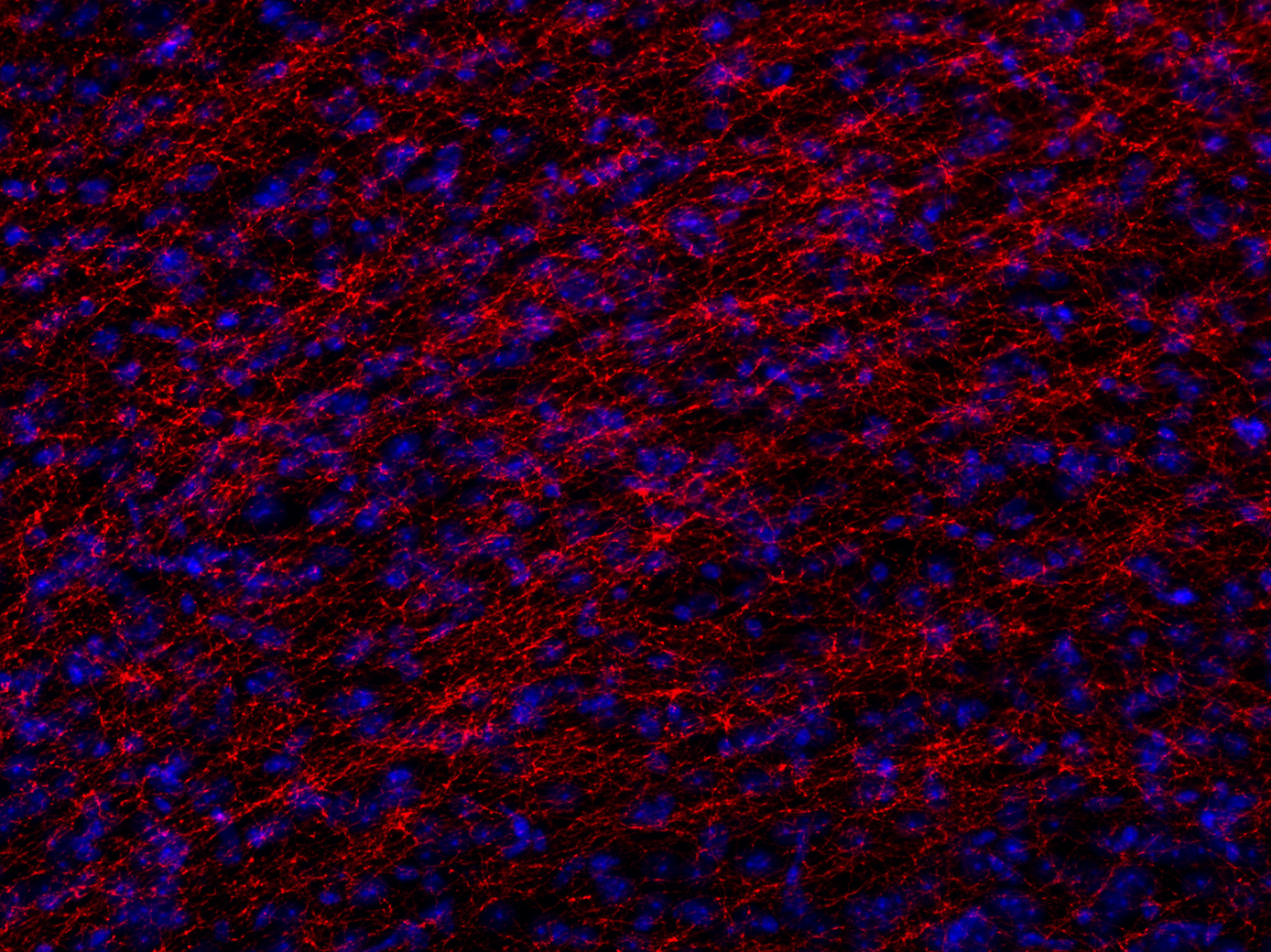 SERT, Recombinant rabbit