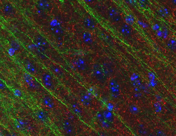 GAP43, Polyclonal rabbit purified antibody