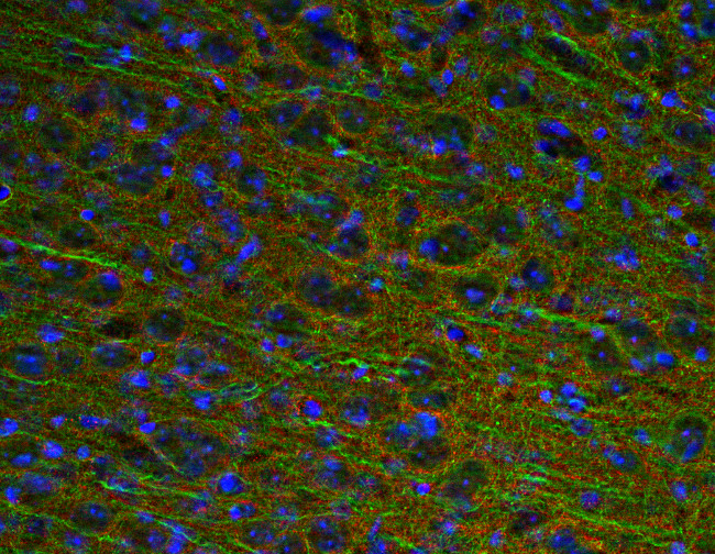 GAP43, Polyclonal Guinea pig antiserum