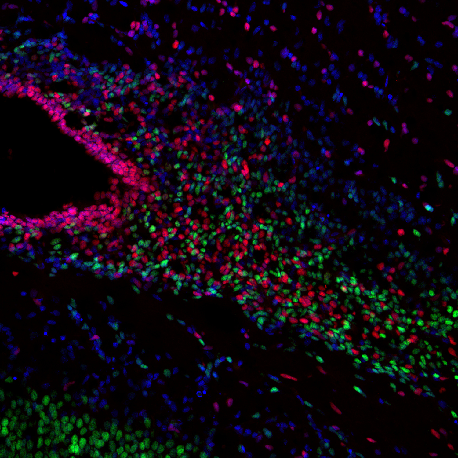 SOX3, Polyclonal Guinea pig antiserum