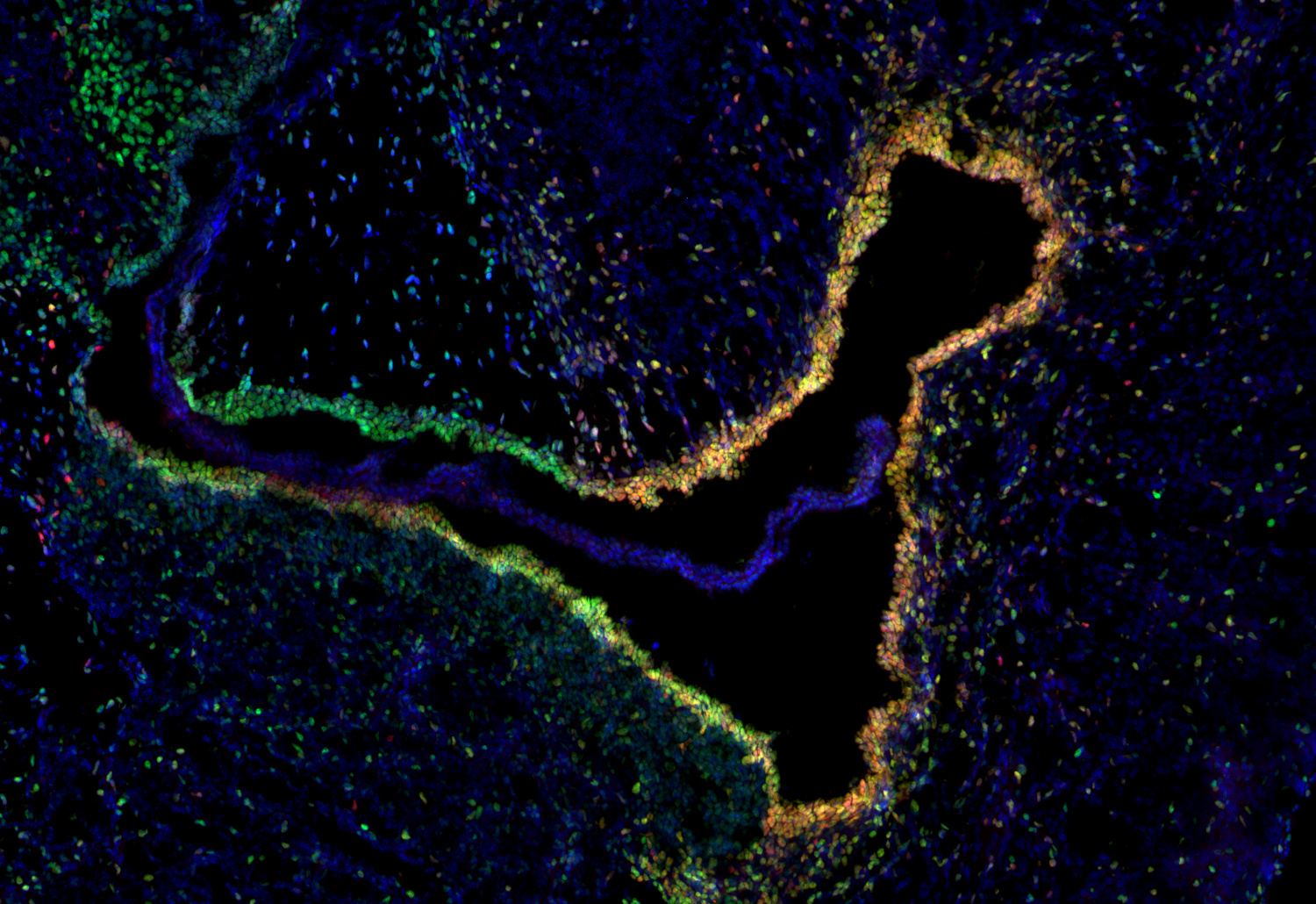 SOX3, Polyclonal Guinea pig antiserum