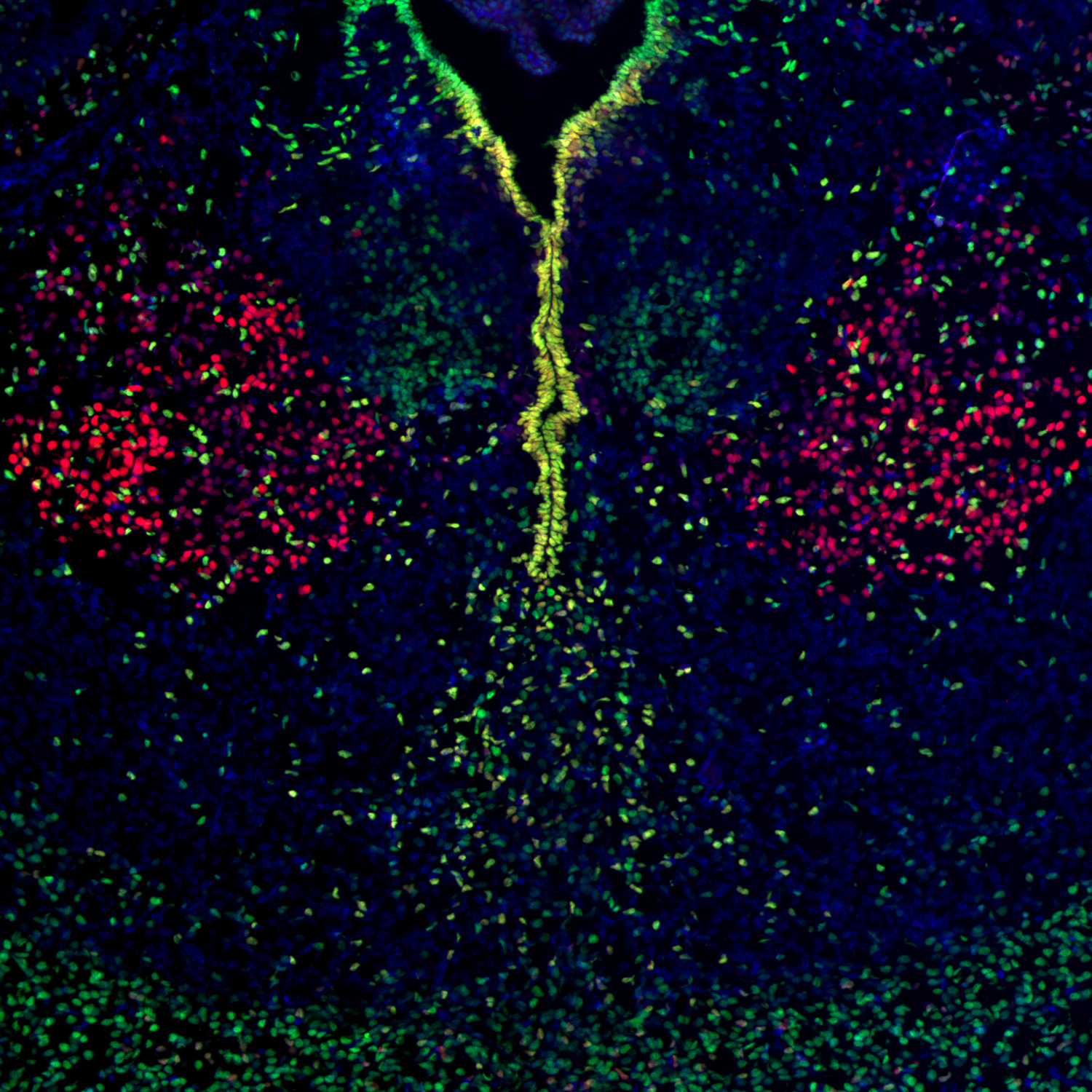 SOX1, Polyclonal Guinea pig antiserum