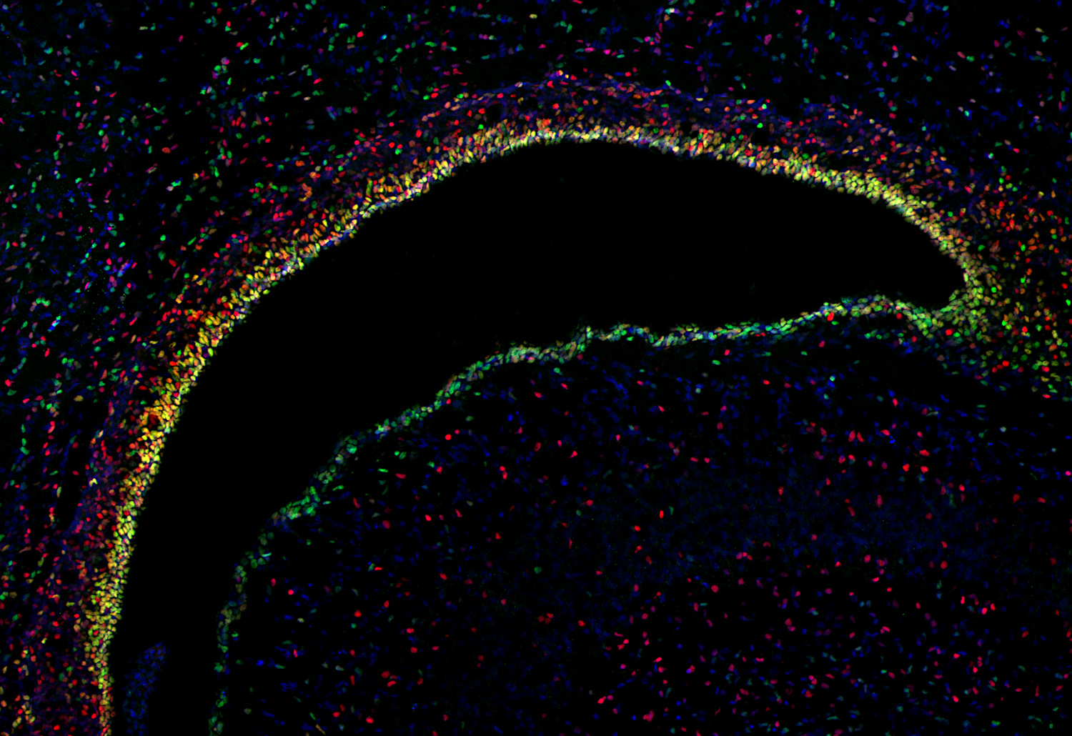 SOX1, Polyclonal Guinea pig antiserum