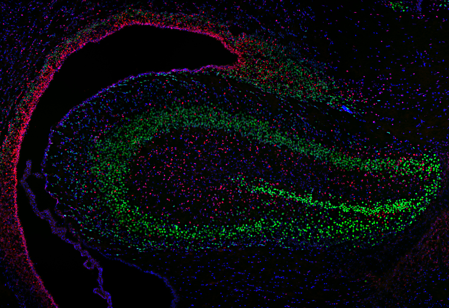 SOX1, Polyclonal Guinea pig antiserum