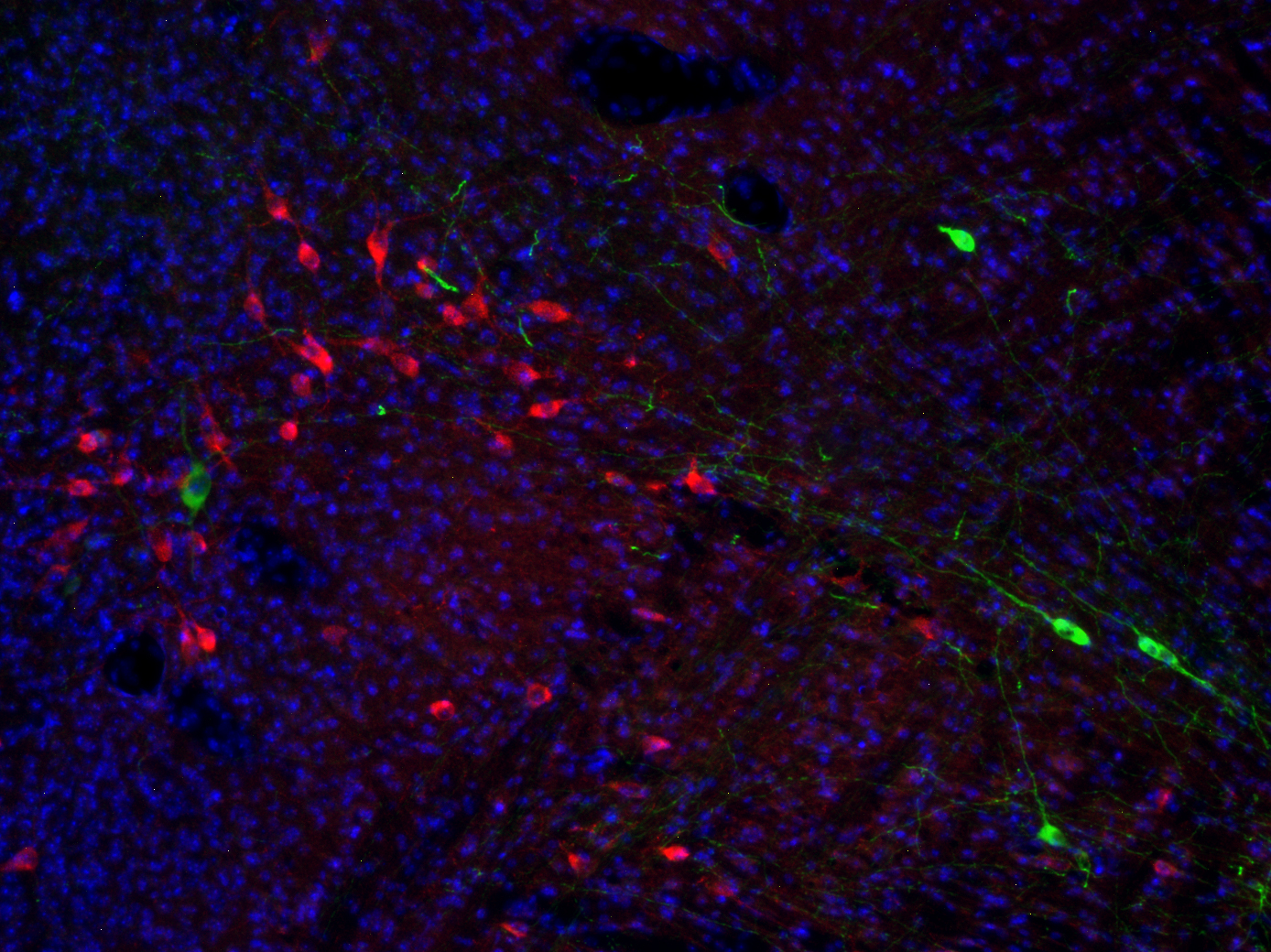Tryptophan hydroxylase2 Recombinant rabbit - image 2