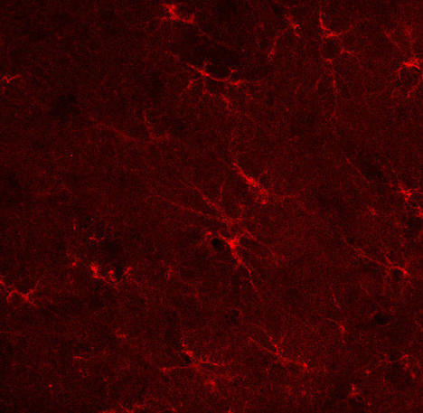 Glutamine synthetase Polyclonal Guinea pig antiserum - image 2