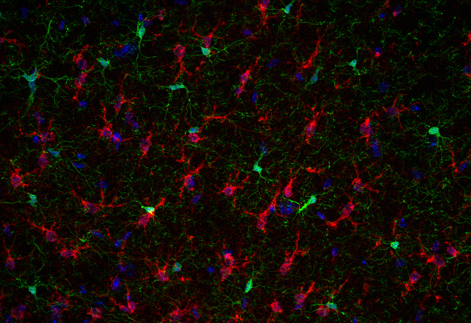Glutamine synthetase Recombinant rabbit - image 5