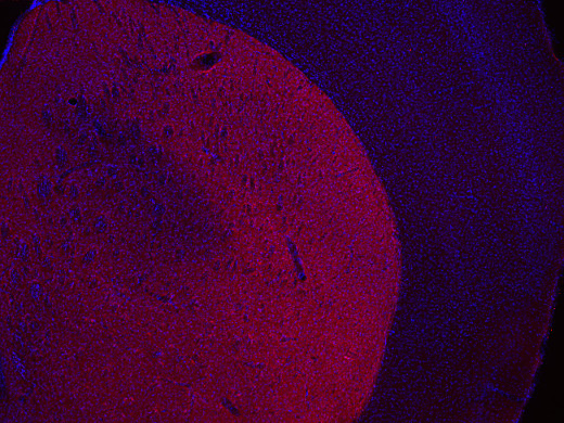 DARPP32, Polyclonal rabbit antiserum