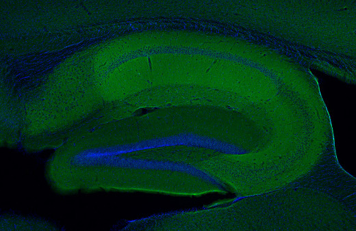 Calcineurin A Polyclonal rabbit antiserum - image 3