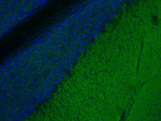 Calcineurin A Polyclonal rabbit antiserum - image 4