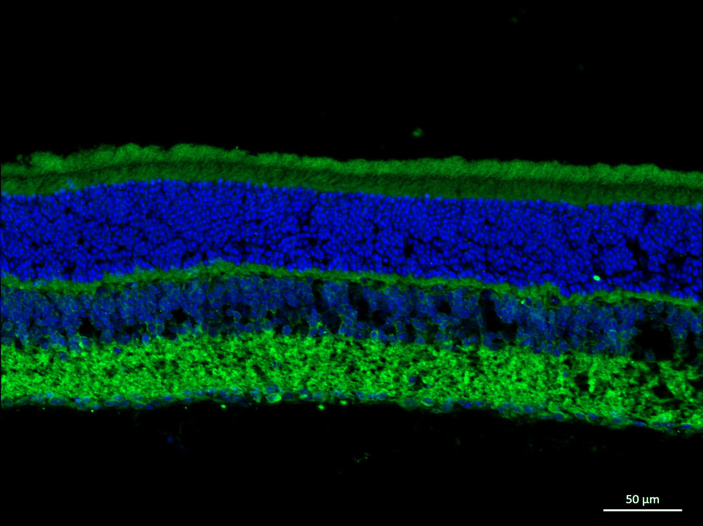 Calcineurin A Polyclonal rabbit antiserum - image 5