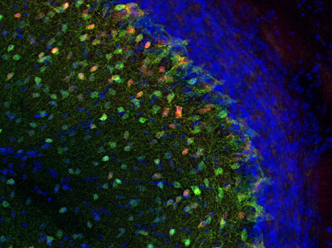 RFP, Polyclonal Guinea pig antiserum