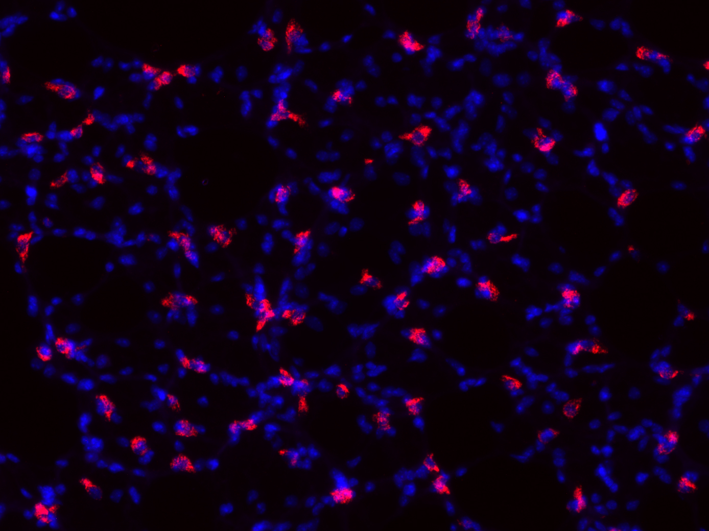LAMP3, Polyclonal Guinea pig antiserum