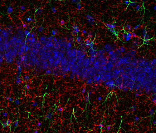 TMEM119, Polyclonal rabbit antiserum