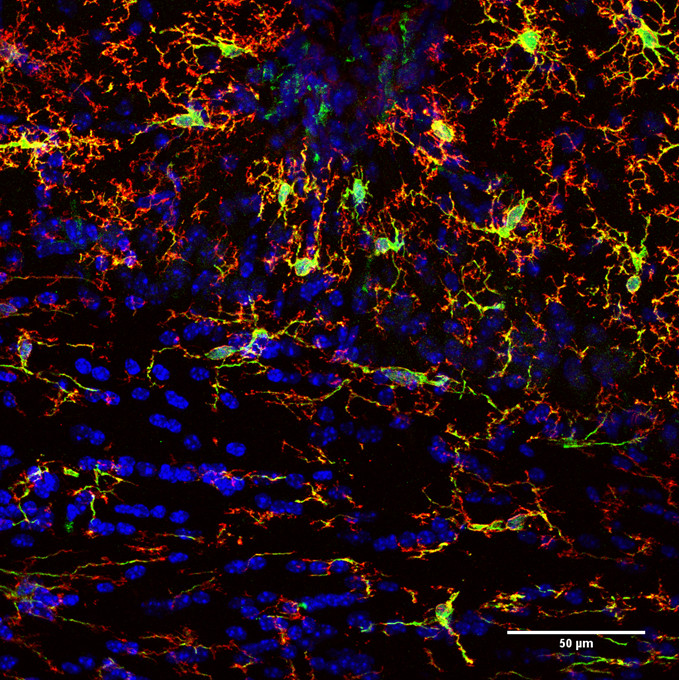 TMEM119, Polyclonal rabbit antiserum