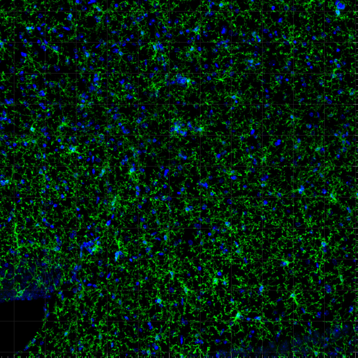 TMEM119, Polyclonal rabbit antiserum