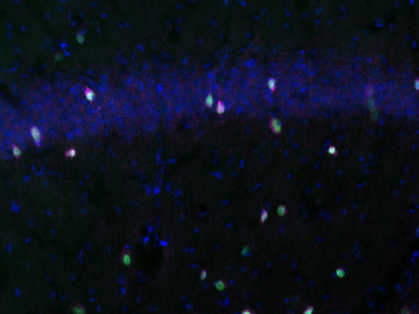 RFP, Recombinant rabbit