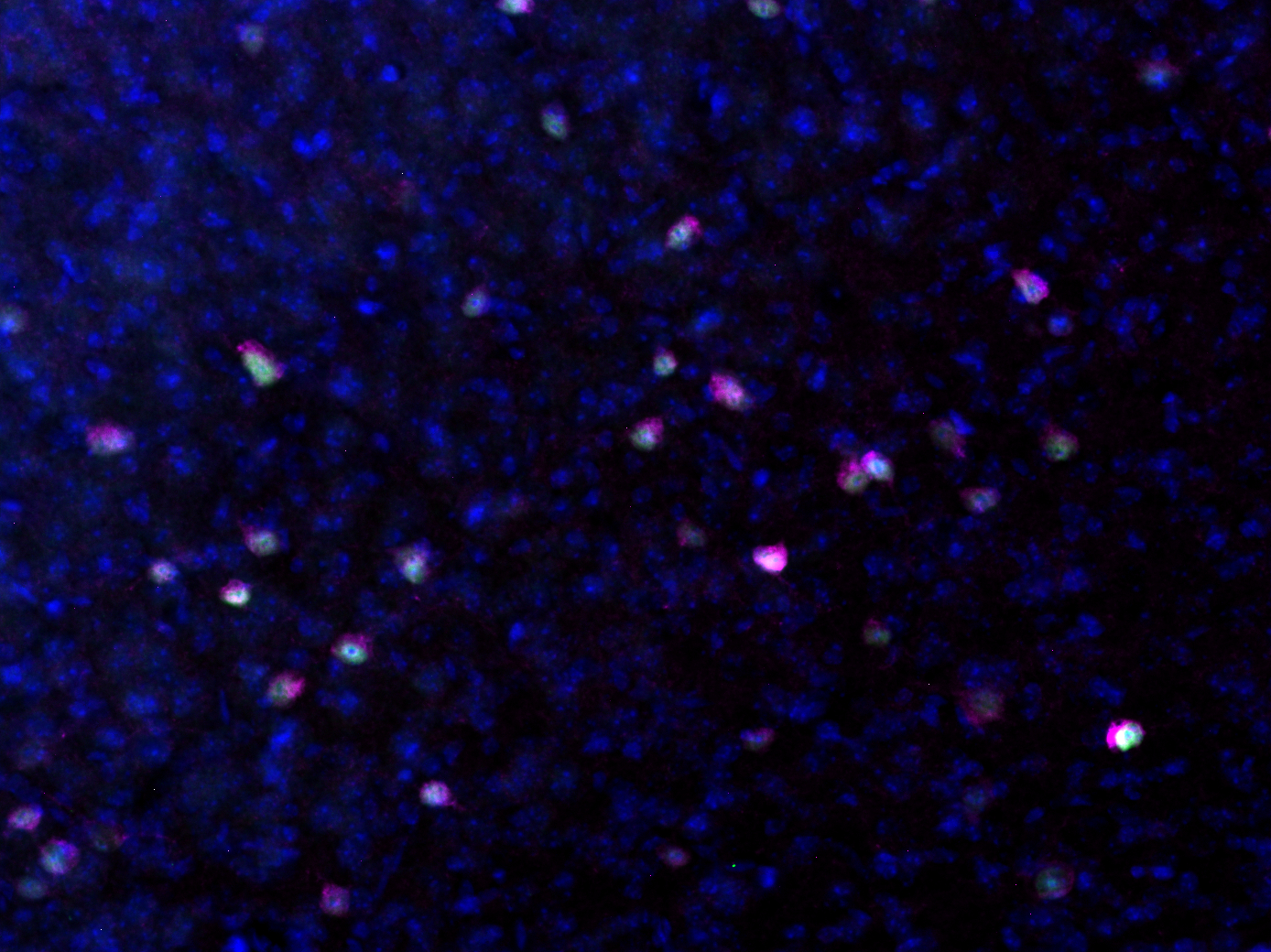RFP, Recombinant rabbit