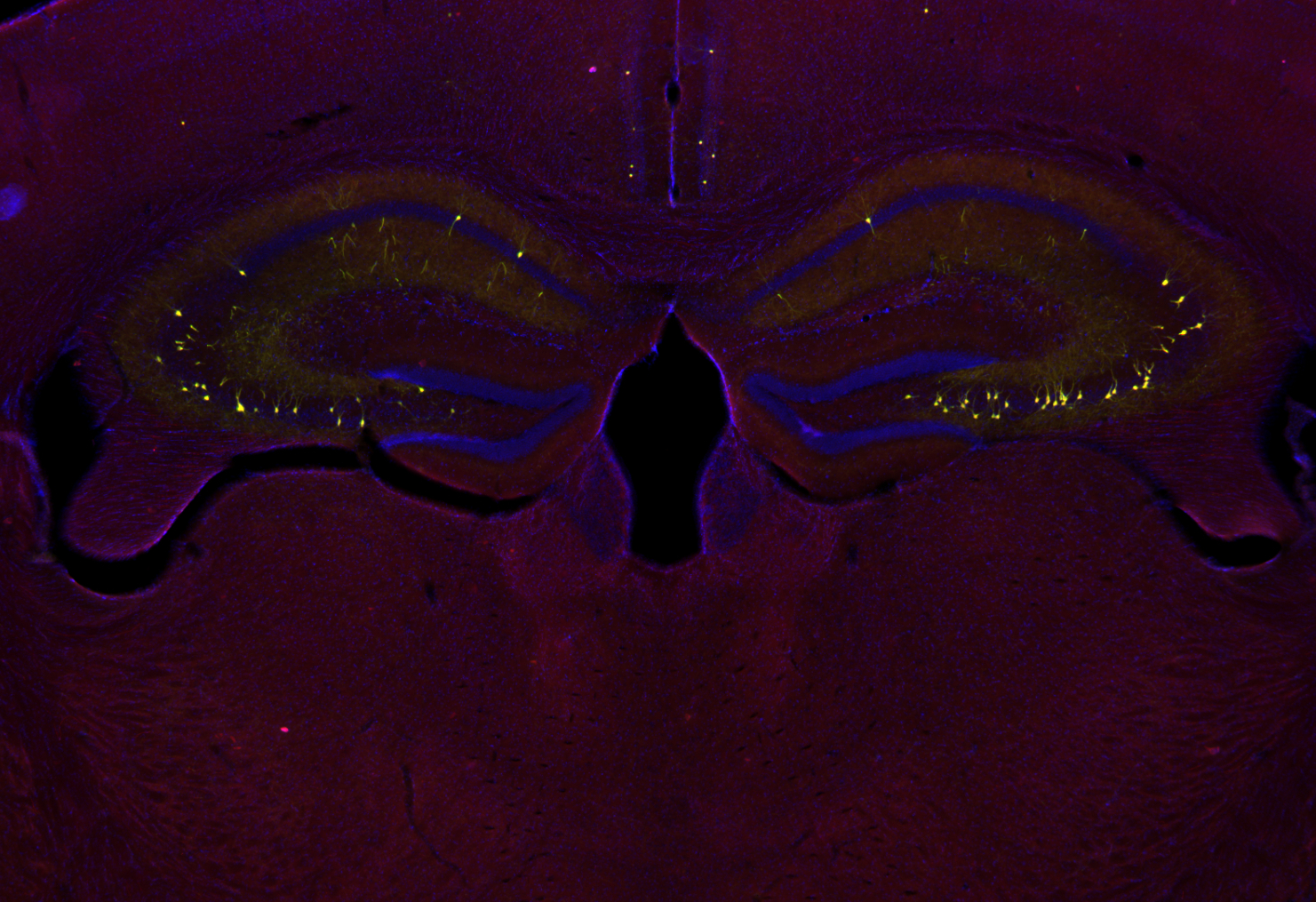 RFP Recombinant chicken - image 4