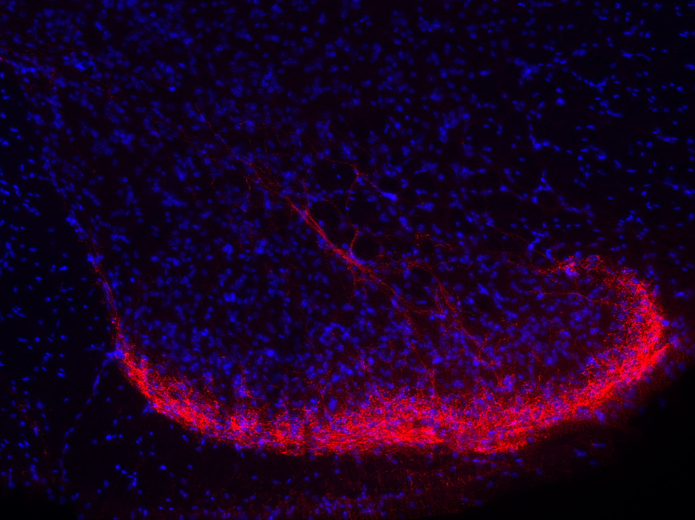 CGRP, Polyclonal Guinea pig antiserum